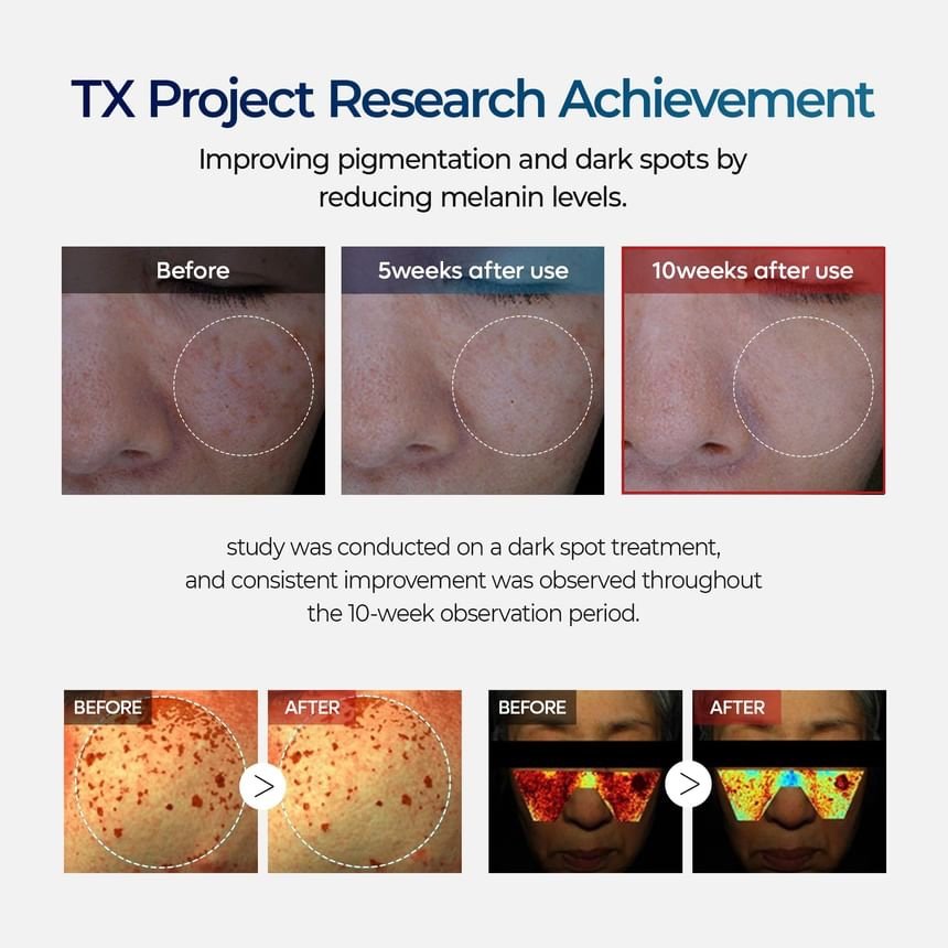 Dr.Melaxin - TX Cream - Crème visage – Image 2