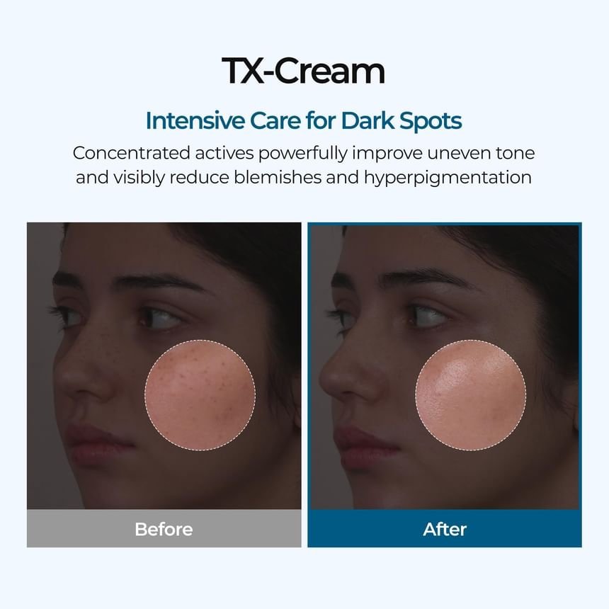 Dr.Melaxin - TX Cream - Crème visage – Image 3
